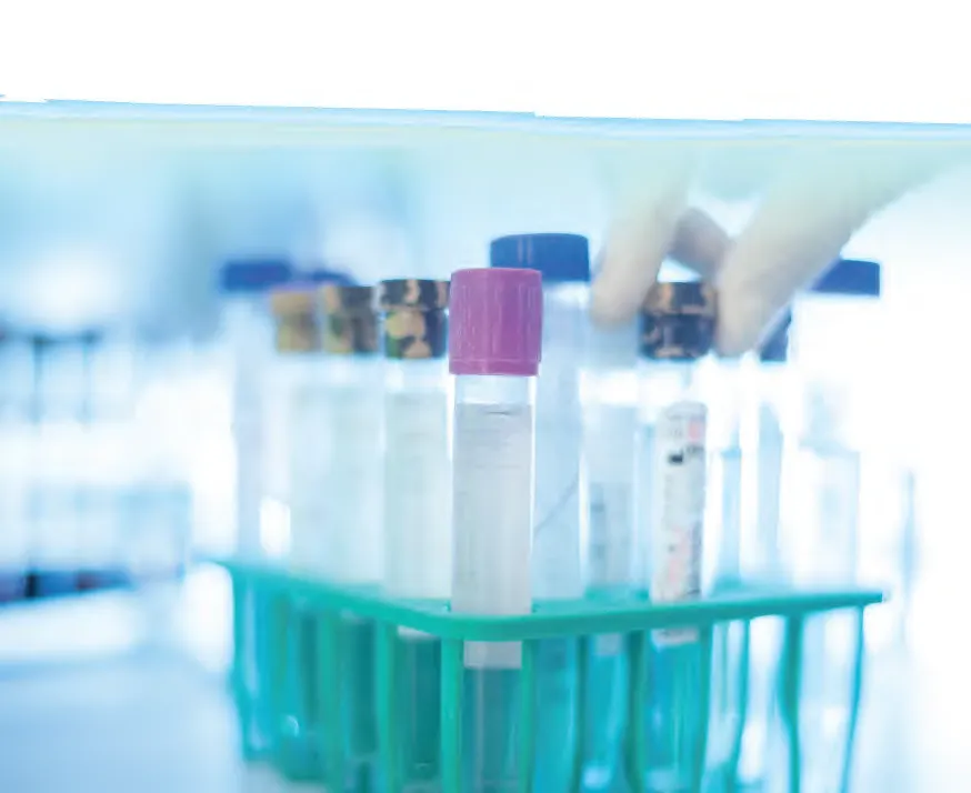 Karyotype kết quả dịch ối